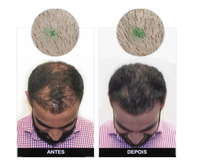 MAN POWER HAIR FUNCIONA